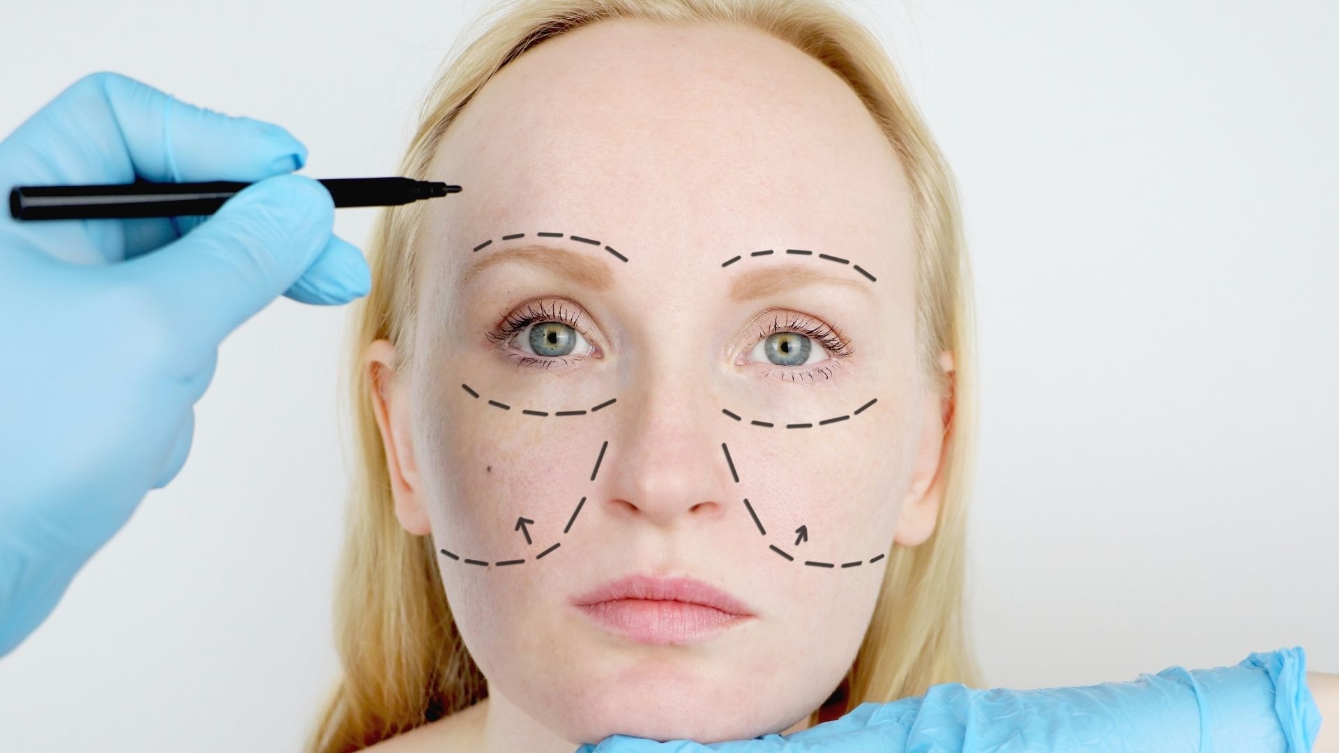 facelift (rhytidectomy) consultations Monmouth County